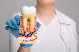 Signs You May Need a Root Canal Treatment