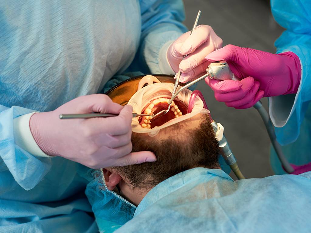 How Often Should Your Really Get a Dental Cleaning